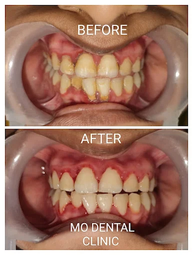 Cosmetic Smile Makeover poster details